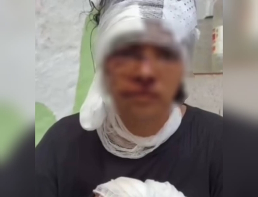 الأميرة-لالة-مريم-تتكفل-بضحية-“الاعتداء-الوحشي”-في-تازة