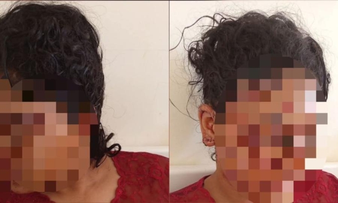 مرصد-حقوقي-يندد-بالاعتداء-الشنيع-على-شابة-تازة