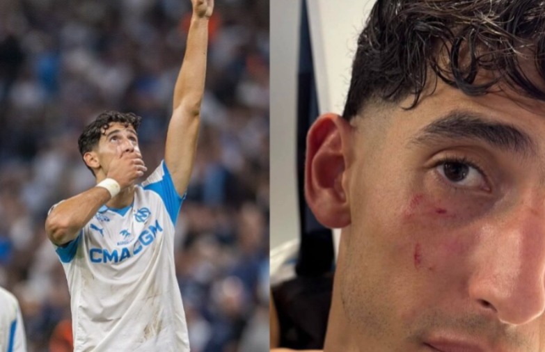 أكرد-يكشف-عن-حيثيات-تعرضه-للاعتداء-بمطار-مارسيليا-ويطمئن-جماهيره