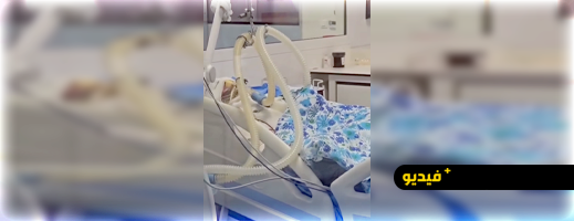 مصدر-طبي-يفند-رواية-وفاة-الفنان-“سوليت”