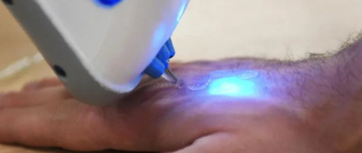 ثورة-طبية.-جهاز-جديد-يرصد-مستوى-السكر-في-الدم-دون-إبر