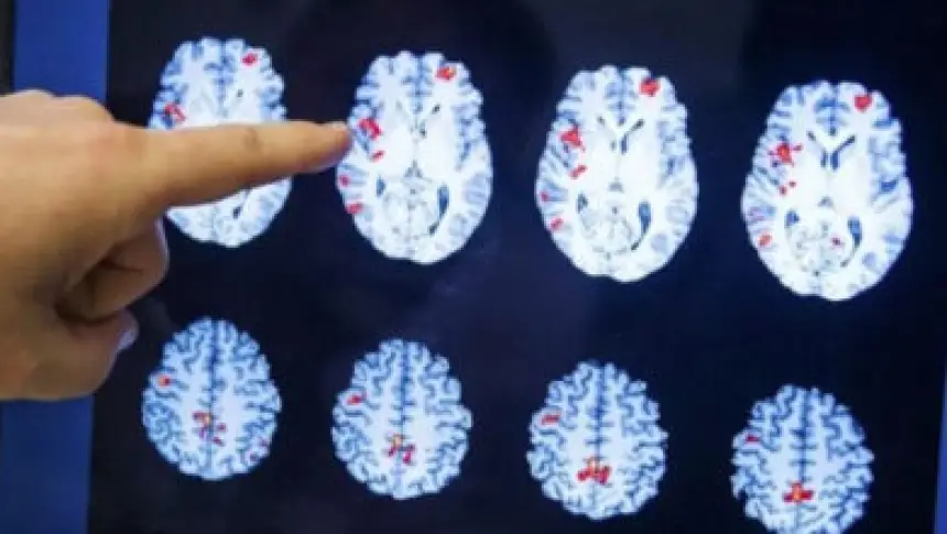 أزمة-صامتة-تضرب-أميركا.-ارتفاع-مقلق-في-الإعاقات-الإدراكية