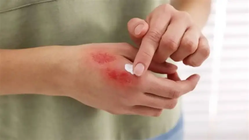 علماء-روس-يبتكرون-هلاما-نانويا-يُسرع-التئام-الجروح-العميقة