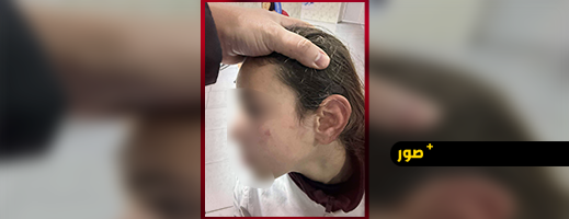 تعنيف-تلميذة-يجر-أستاذة-إلى-شكاية-رسمية-بالناظور