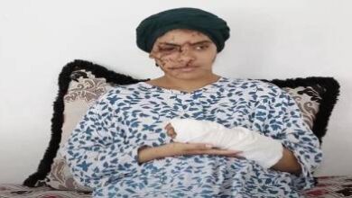 تازة:-130-غرزة-على-وجه-إيمان.-والعدالة-تقضي-بالسجن-15-سنة-للطليق