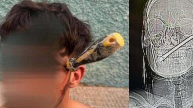 إسبانيا.-شاب-مغربي-ينجو-من-موت-محقق-بعد-تعرضه-لاعتداء-من-طرف-جزائري-بسبب-خلاف-مالي