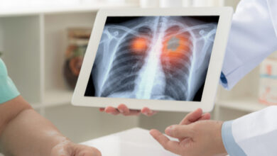 وزارة-الصحة والحماية-الاجتماعية-تعزز-جهود-الكشف-والتكفل-بجميع-أشكال-السل-بمناسبة-اليوم-العالمي-لمكافحة-السل-2026