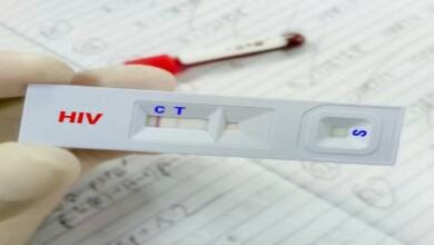 أزمة-صامتة-تهدد-مكافحة-السيدا-في-المغرب.-اضطراب-في-توفير-اختبارات-الكشف-السريع